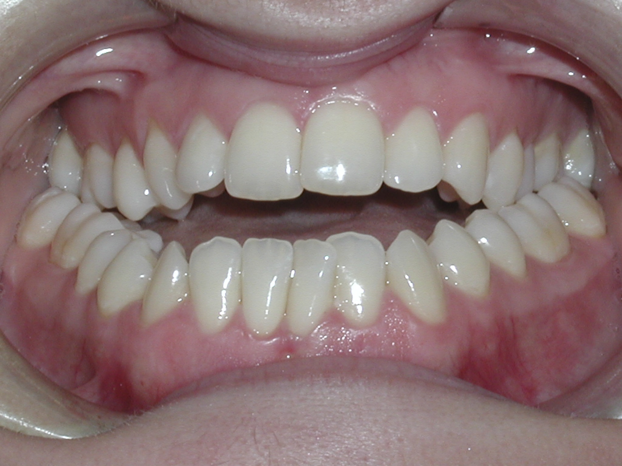Surgery case picture 1