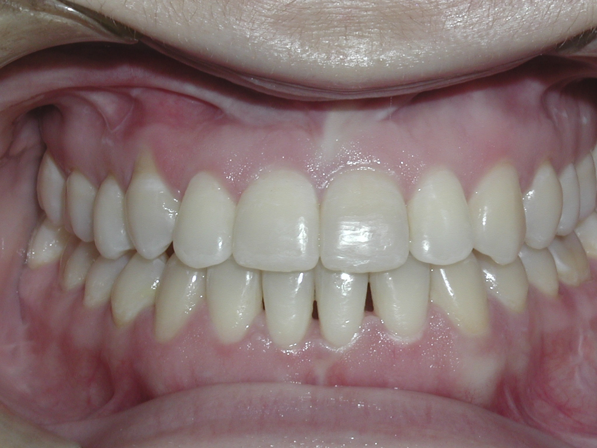 Surgery case picture 1