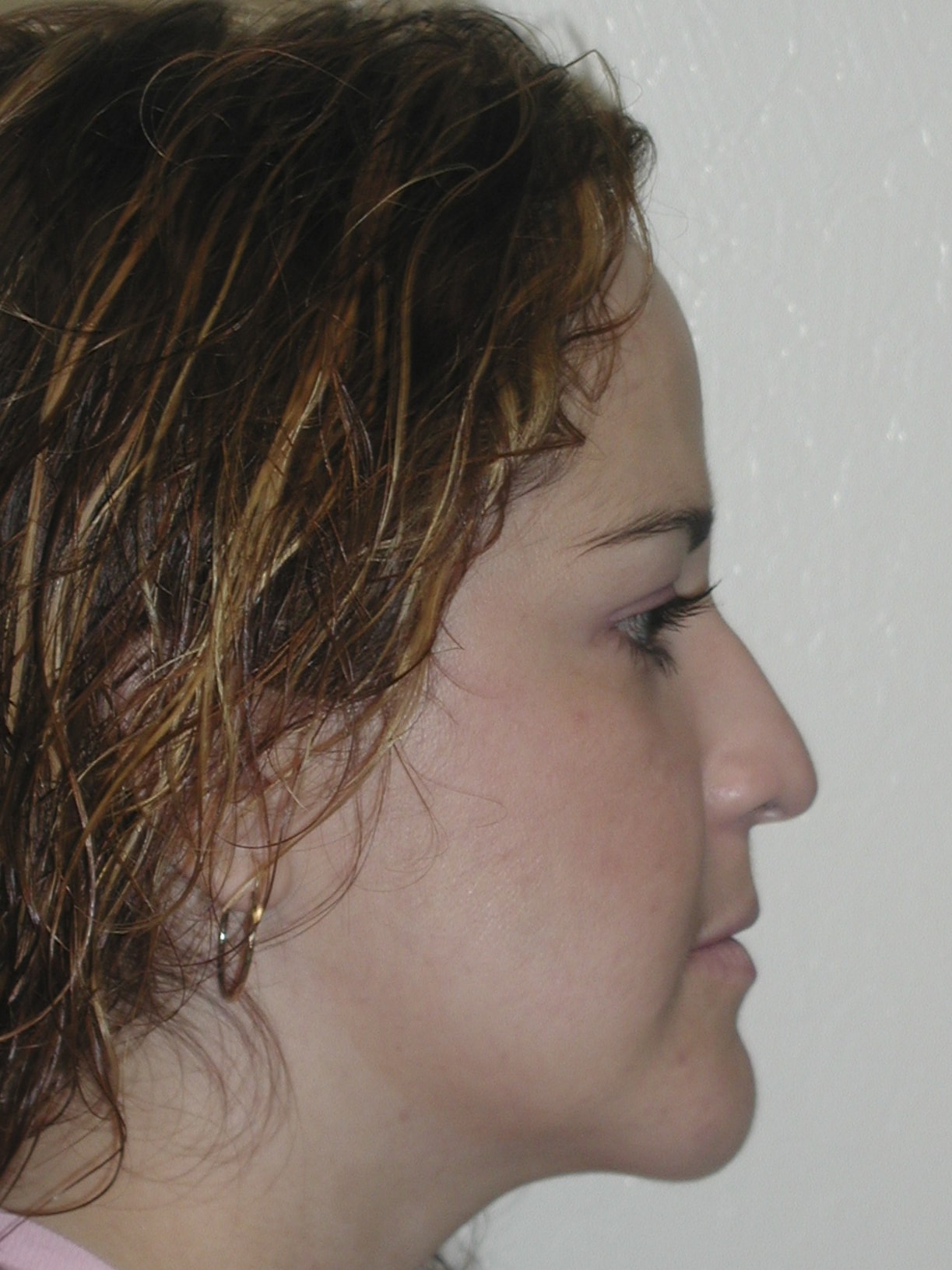 Surgery cae picture 1